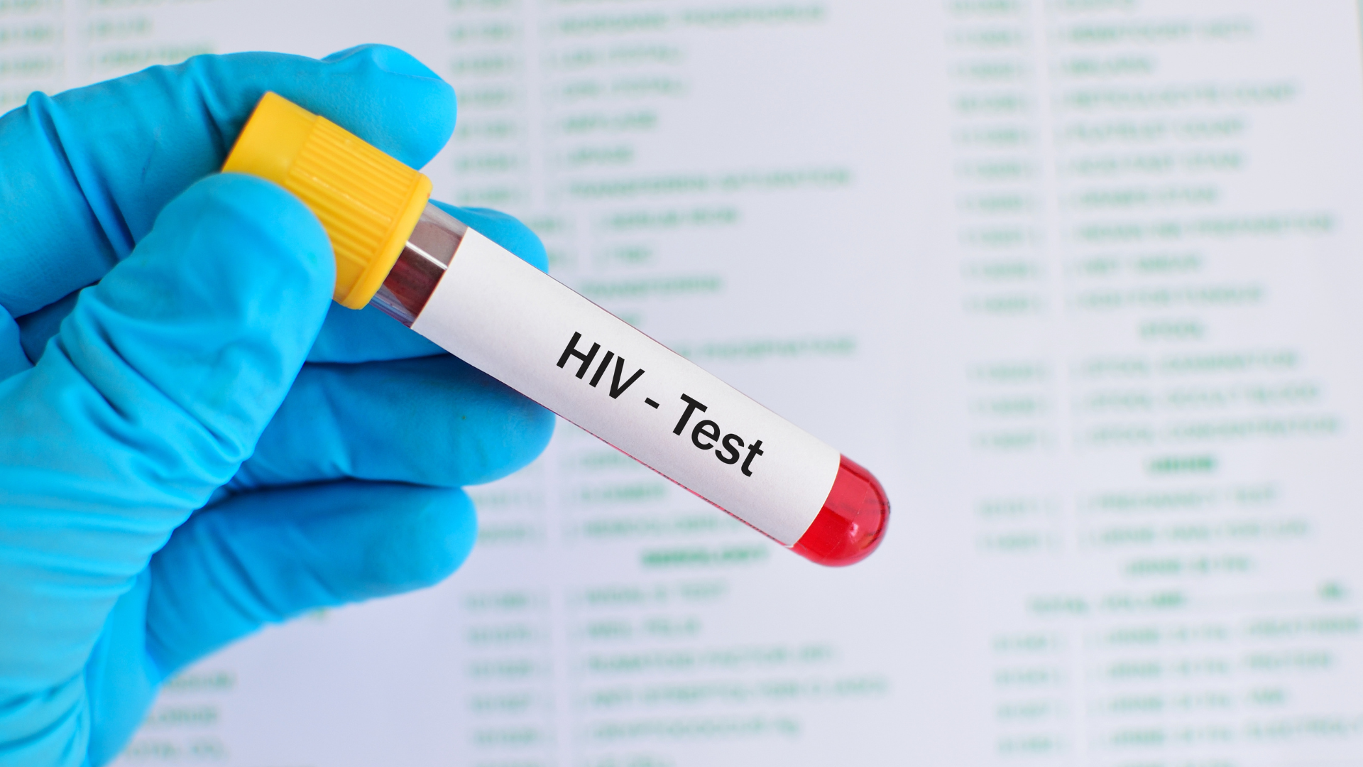 Mua test HIV ở đâu, nơi nào bán test HIV uy tín, tìm mua que thử HIV tại nhà